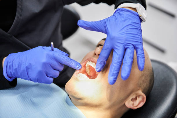 Best Emergency Tooth Extraction in Burnsville, MN